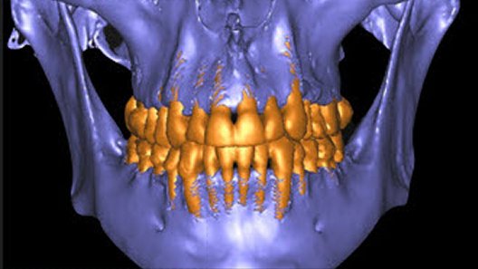 CBCT — Pre-treatment baseline